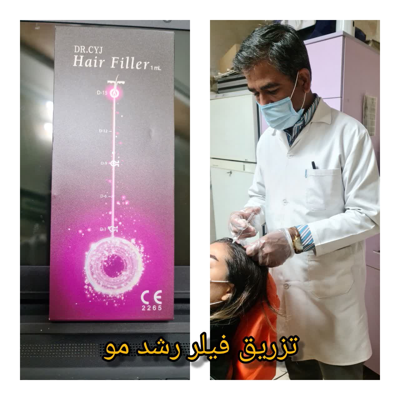 Hair growth filler injection